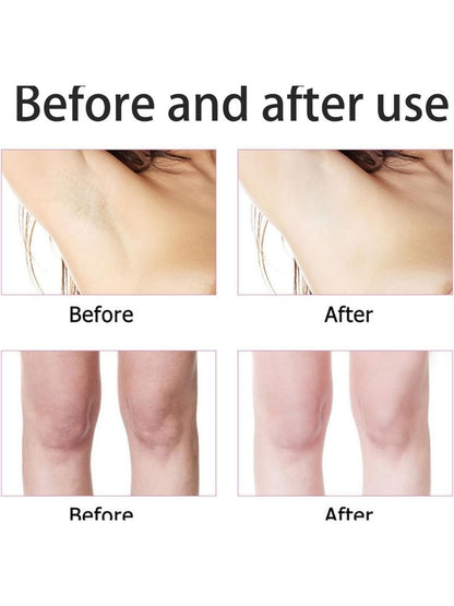 Kojic Acid and Collage, Whitening Cream for underarm by Kormesic, Cream, Unisex, 50 ML